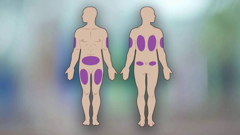 Zeel T Inyectable: Beneficios y Aplicaciones